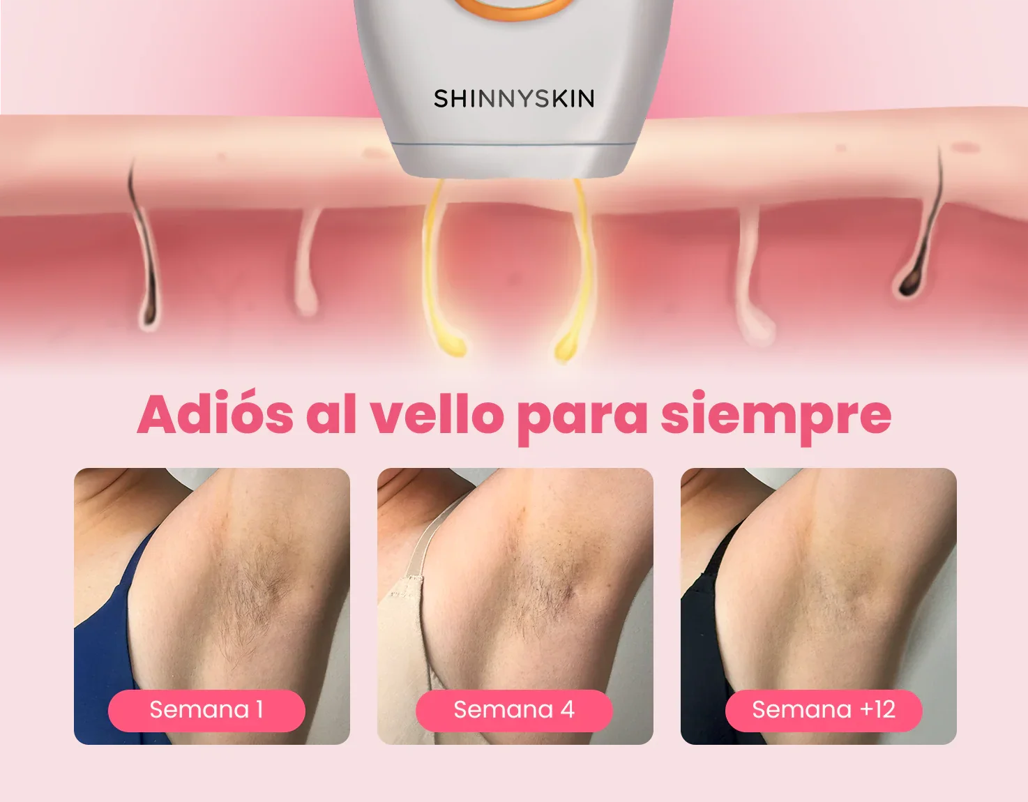 Depiladora Permanente IPL - Lunara